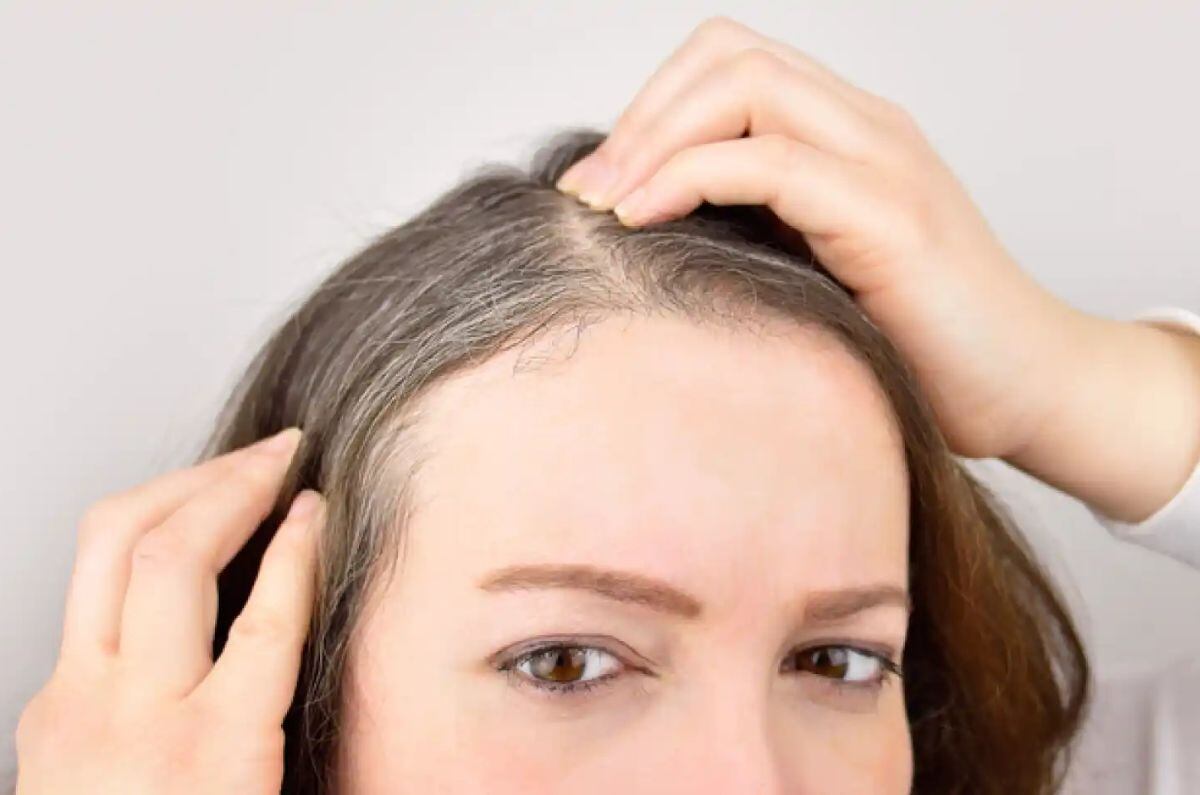 Los 3 nutrientes esenciales para retrasar la aparición de canas, según la ciencia