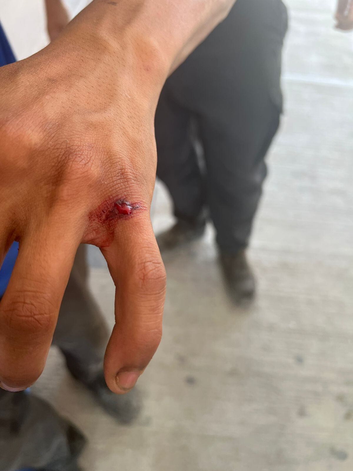 Las lesiones. (Policía)