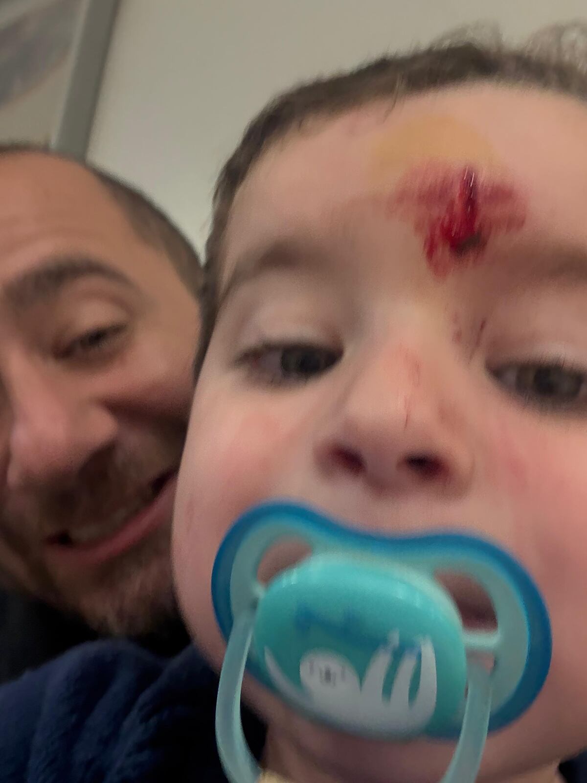 Lolo, el hijo de Camilo Nicolás y Gislena Monteros, terminó en el hospital por un fuerte golpe en la frente (Gentileza Camilo Nicolás)