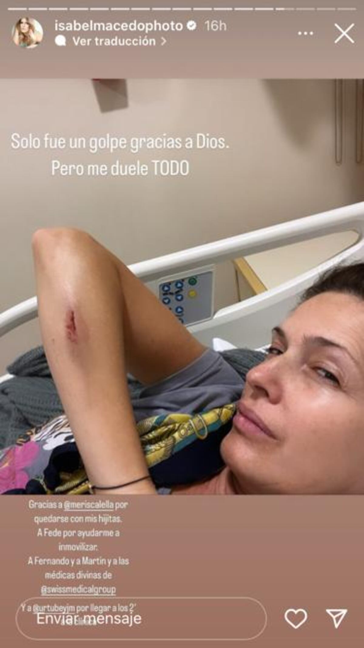 Fuerte accidente doméstico de Isabel Macedo.