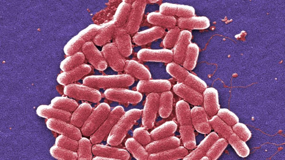BACTERIA. E.coli (Janice Carr/CDC vía AP).
