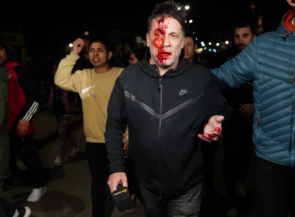 Periodista herido en el acto de La Libertad Avanza. (Clarín)