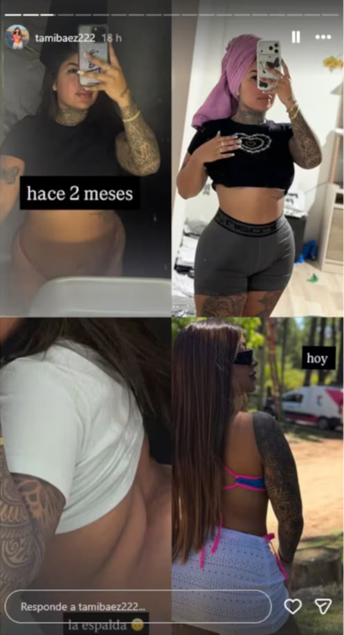 Tamara Báez mostró el antes y después de su cirugía estética.