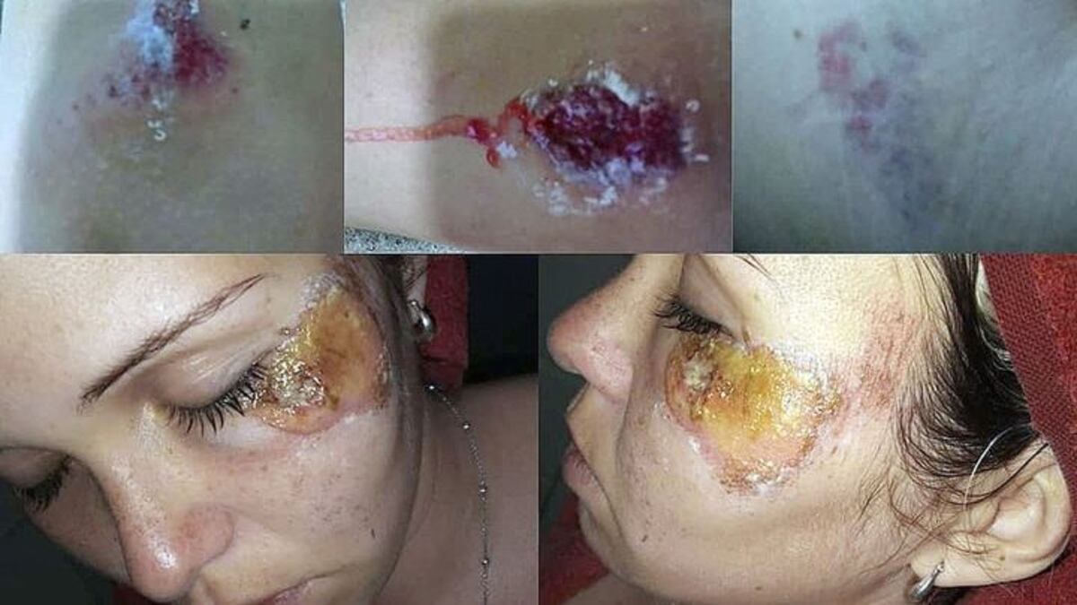 Las lesiones que sufrió la mujer a raíz del hecho de violencia.