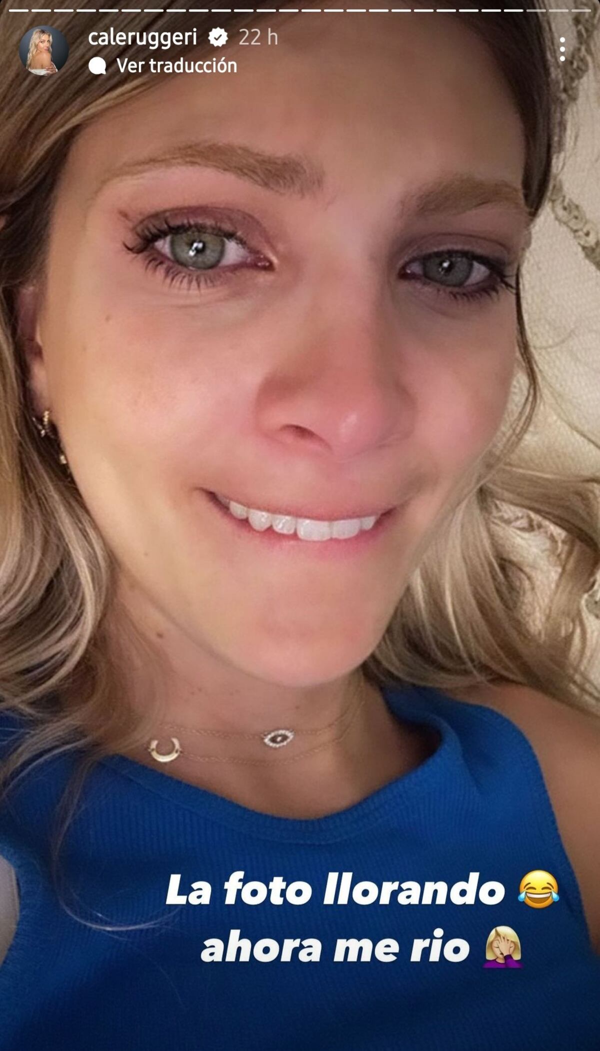 Cande Ruggeri mostró el percance que tuvo con uno de sus dientes (Captura de pantalla)