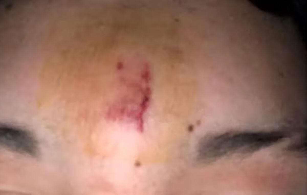 Un profesor le arrojó un borrador en la cabeza a un alumno para callarlo. (Gentileza Infobae)