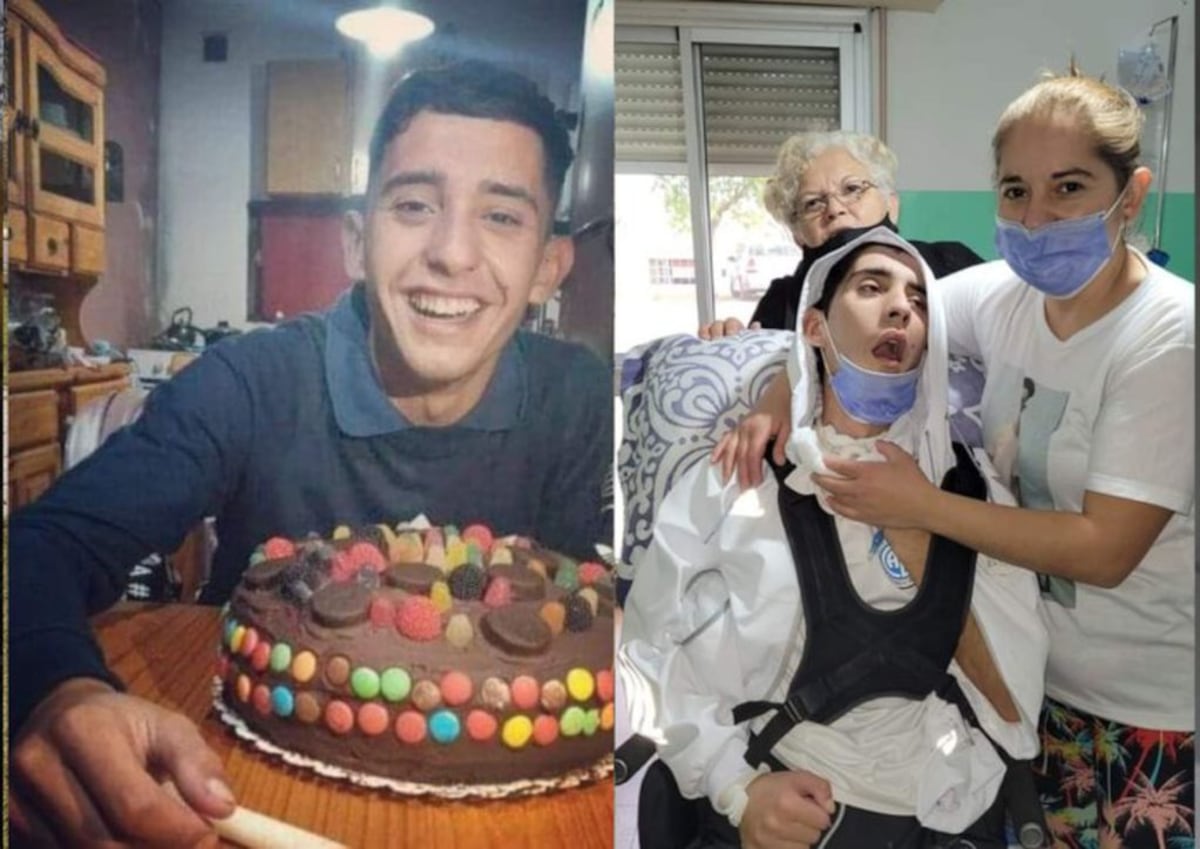 Ignacio fue atropellado y necesita 800 mil pesos para su rehabilitación
