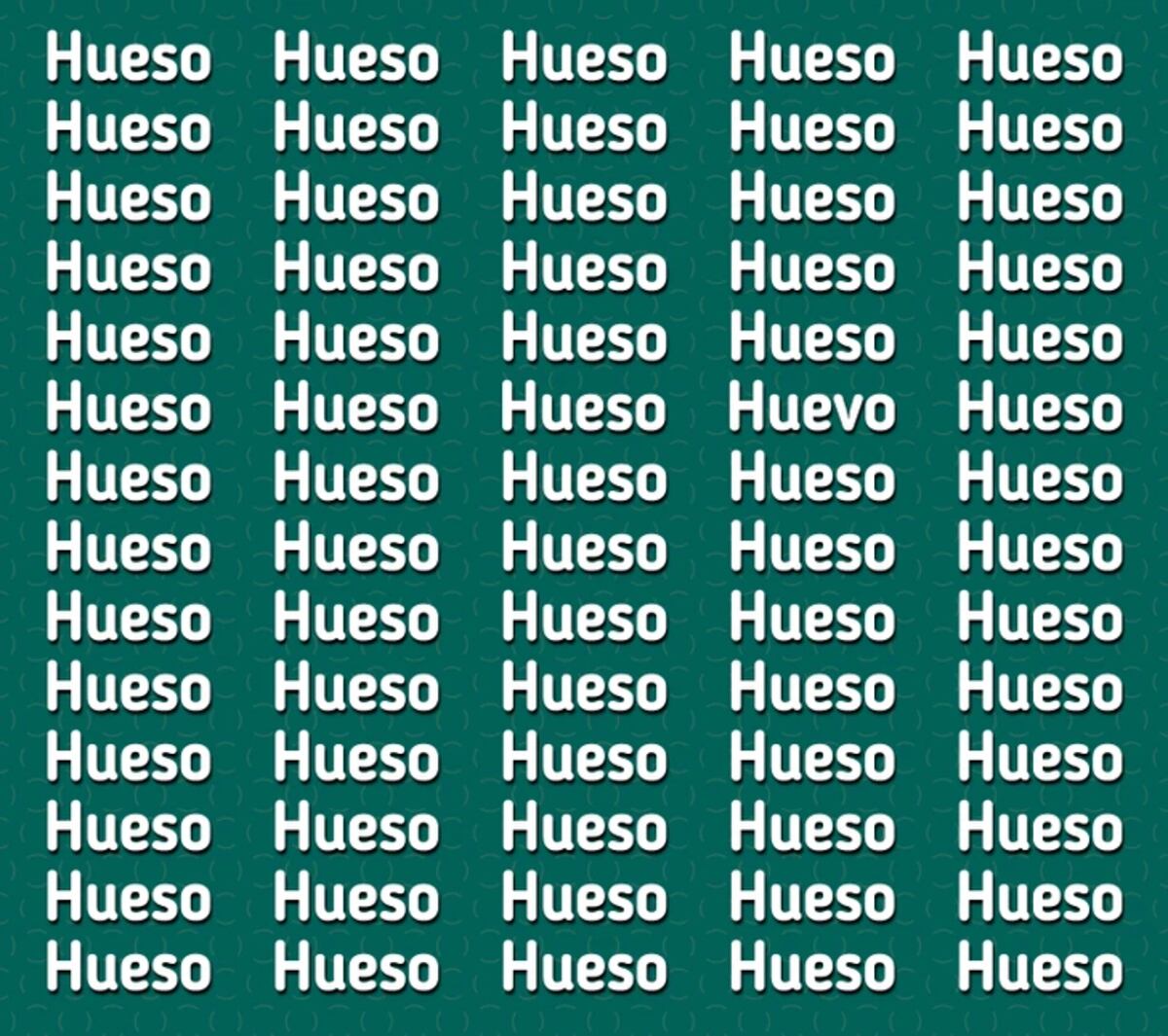 El acertijo visual.