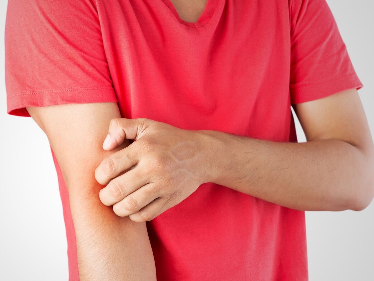 Qué es y cuáles son los síntomas de la enfermedad de Lyme, según Mayo Clinic