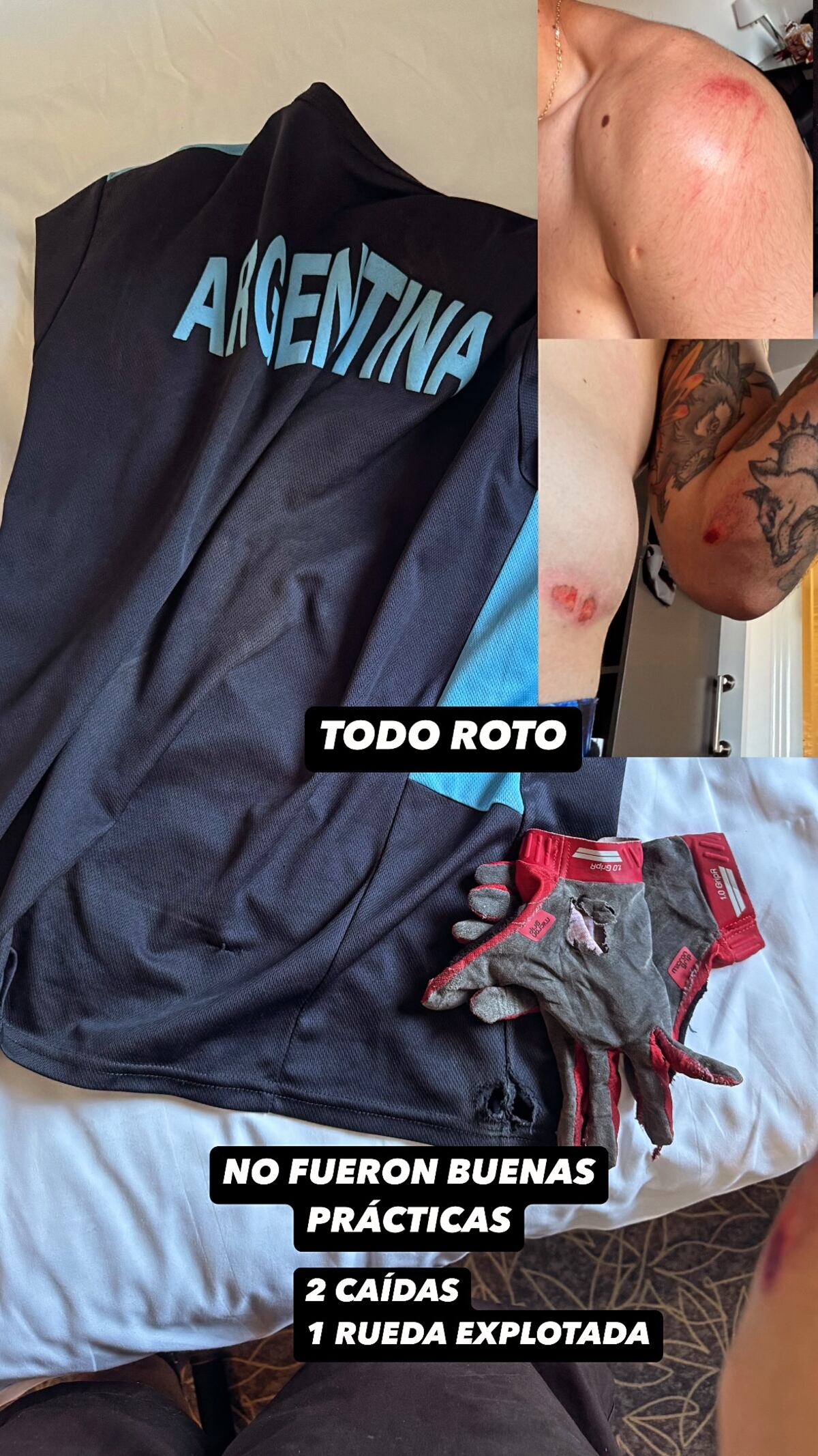 José Maligno Torres sufrió una caída en las pruebas de la primera etapa de la Copa del Mundo, en Montpellier (Francia). (Instagram Maligno Torres)