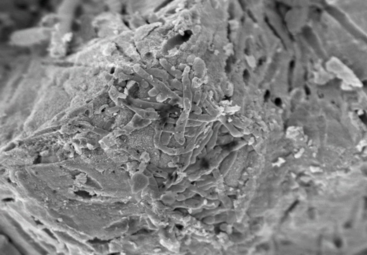 Las bacterias responsables de la biocementación. (Equipo de investigación)