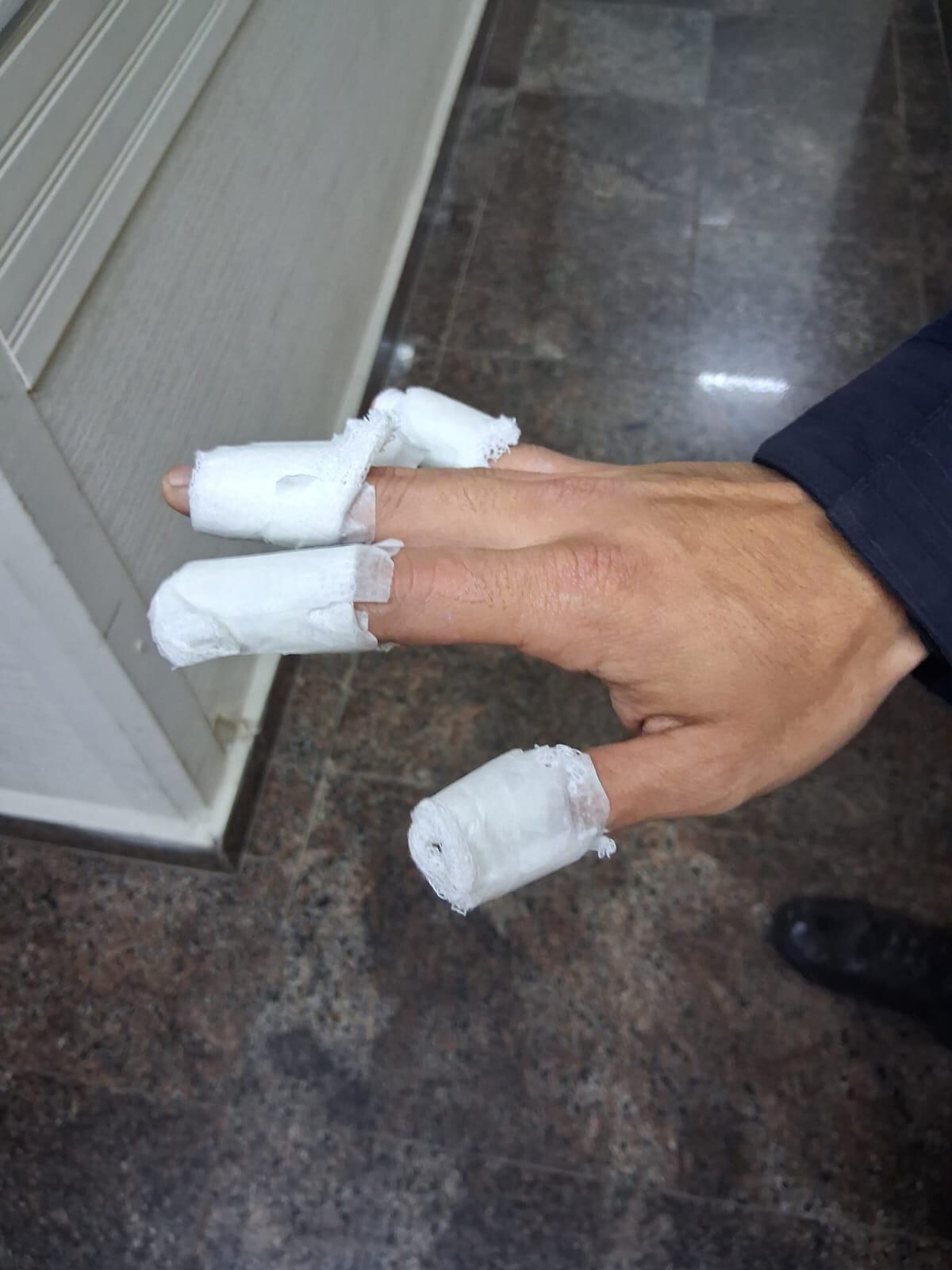 La lesión. (Policía)