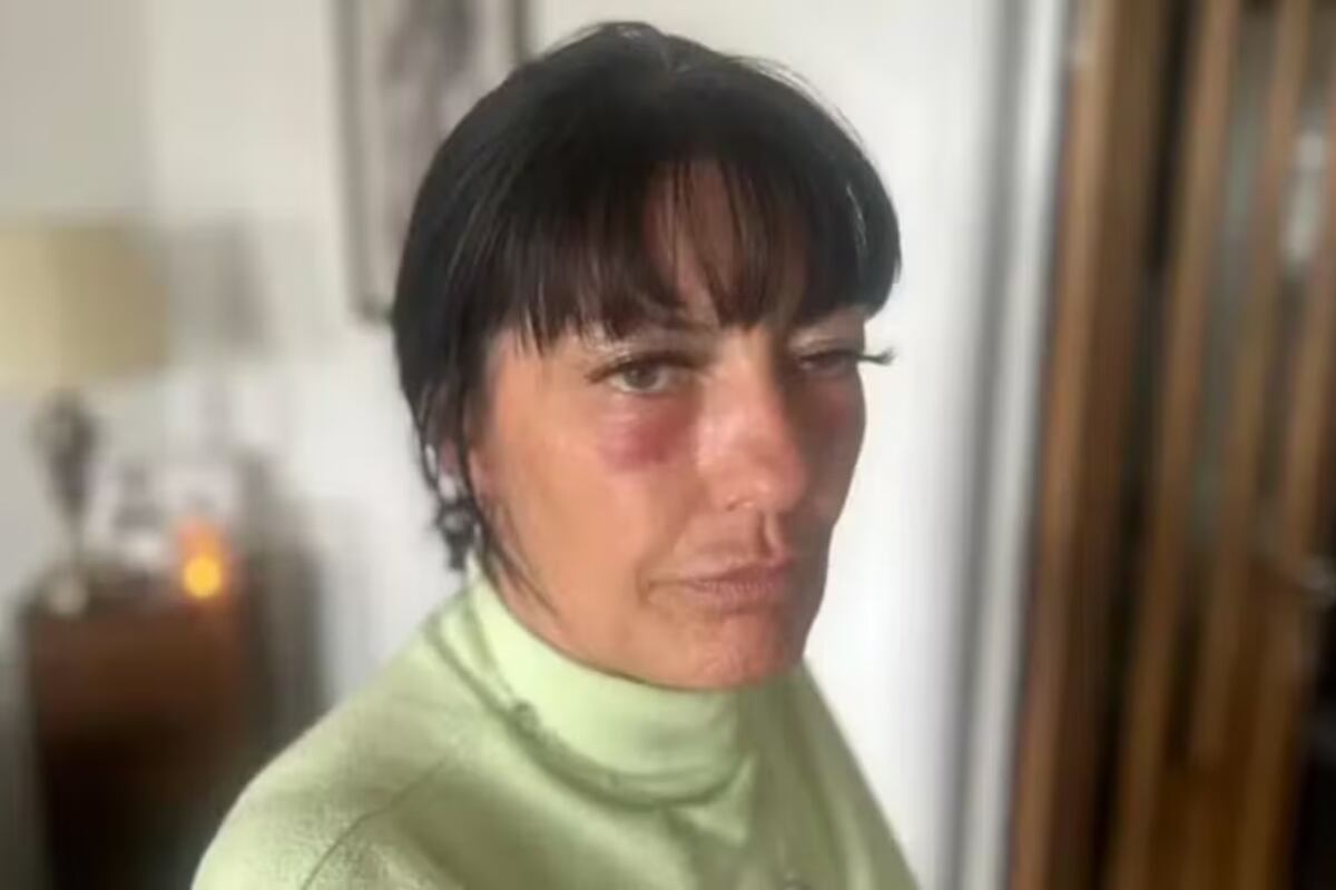 Alarmante: esteticista inyectó “botox falso” a decenas de mujeres dejándolas enfermas y al borde de la muerte. (Gentileza)