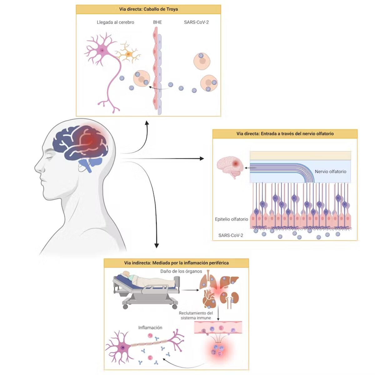 Esquema de las vías directas e indirectas de afectación cerebral debido al SARS-CoV-2. Juana Andreo López, David Baglietto Vargas, Miriam Bettinetti Luque, Author provided