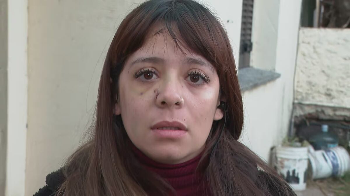 Buenos Aires: le fracturaron la nariz a una mujer tras negarse a dar comida a personas en situación de calle. (Gentileza)