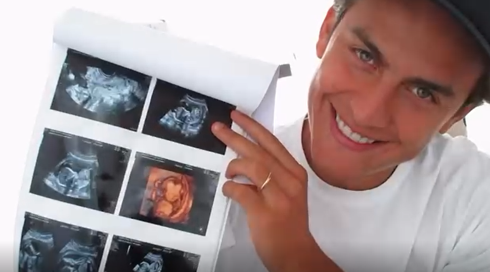 dybala con la ecografia del embarazo