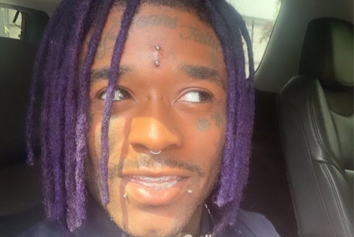 Lil Uzi Vert pasó del diamante millonario a un piercing tras el incidente (IG Lil Uzi Vert).
