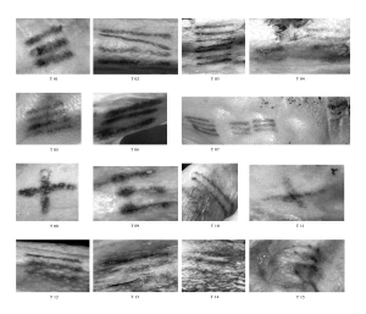 Fotografías de los tatuajes de Ötzi. (El País)