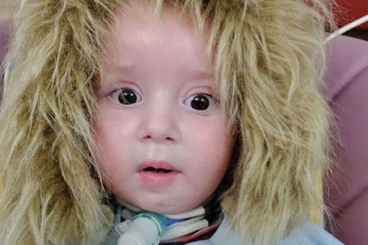 Lolo. En un mes cumple dos años y debe recibir su medicación urgente (La Voz/Archivo).