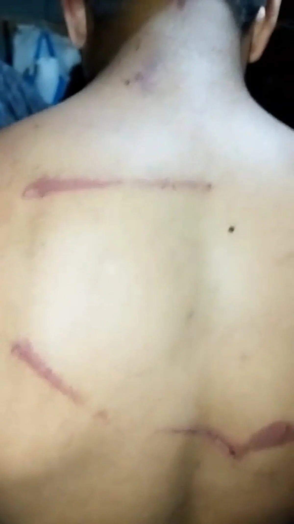 El terrible ataque sucedió a la salida de una fiesta de 15 en Salta. (Gentileza)