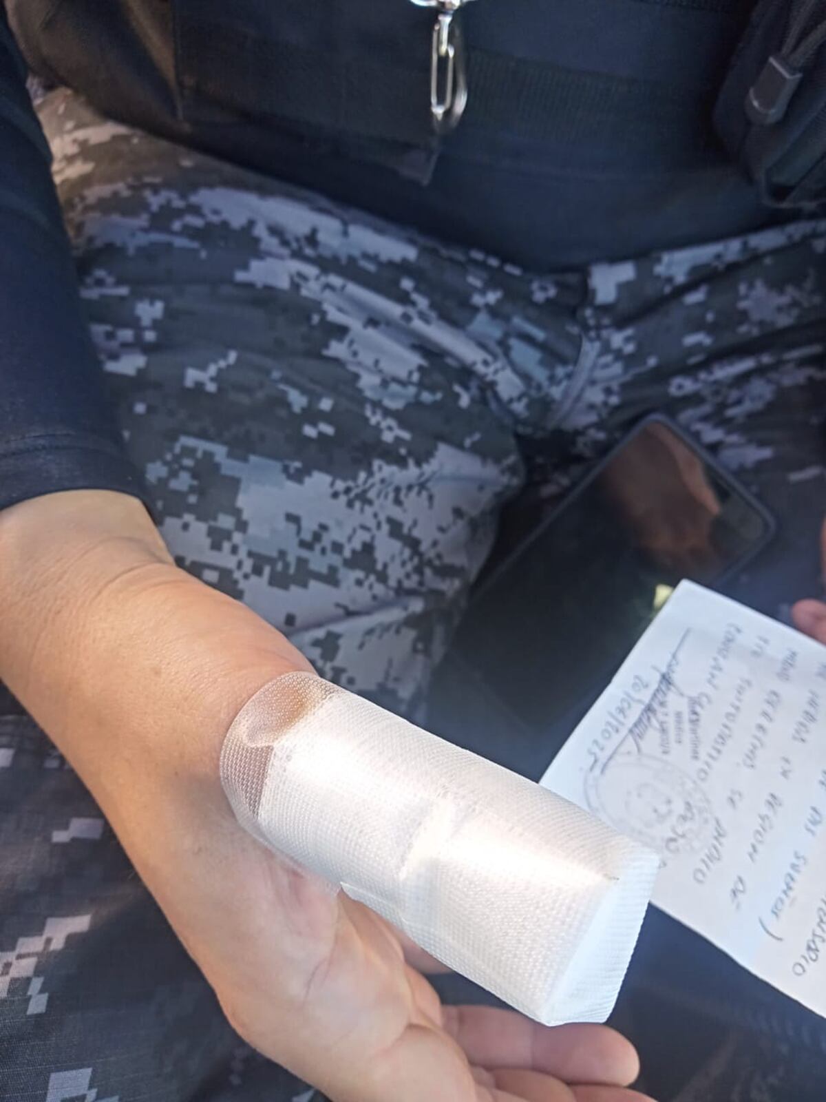El agente que resultó herido con una mordedura en la mano derecha durante un procedimiento policial en Ciudad de Mis Sueños. (Policía de Córdoba)