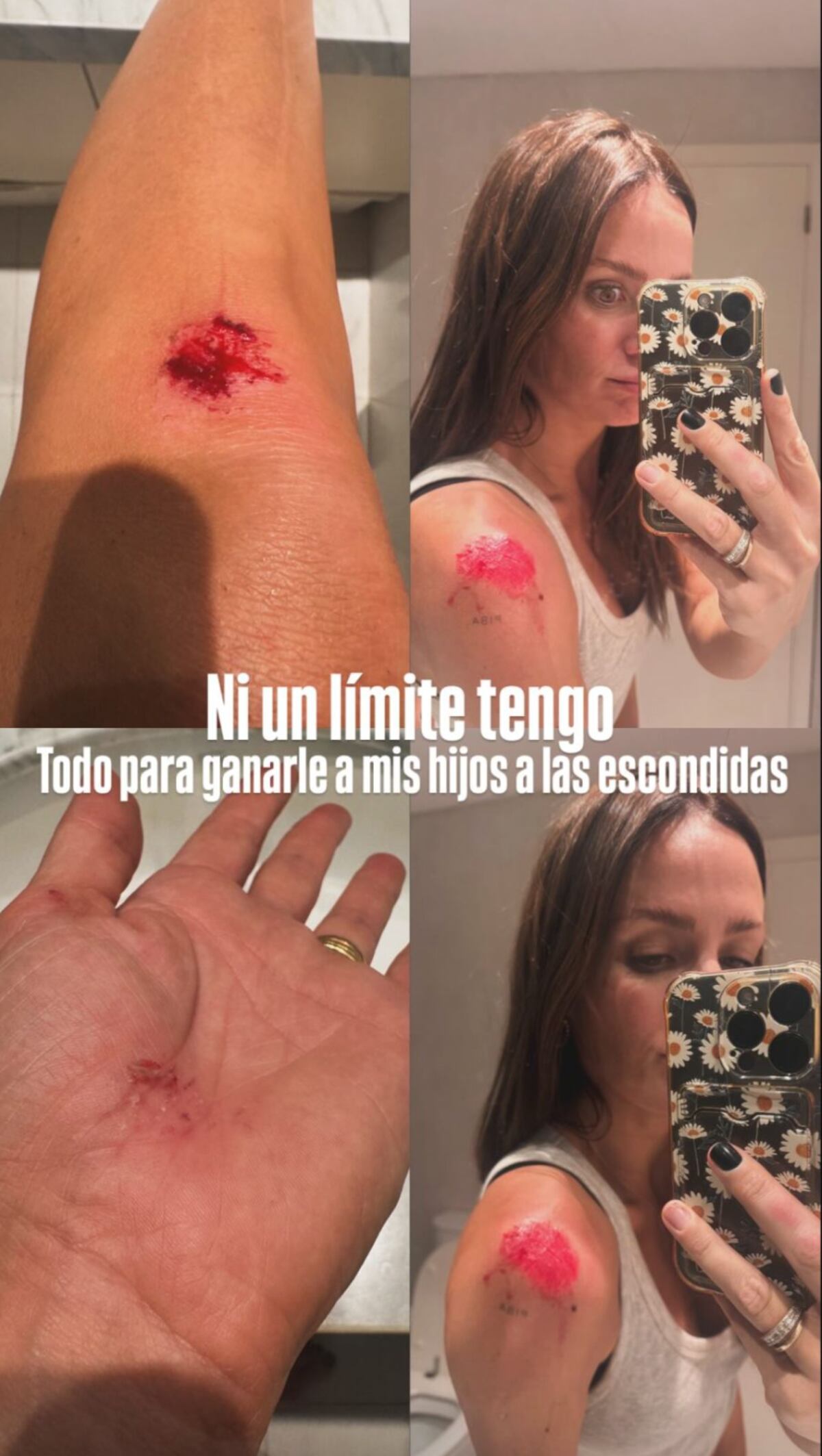 Paula Chaves mostró las lastimaduras que se hizo tras jugar a las escondidas con sus hijos. (Fotos: Instagram)